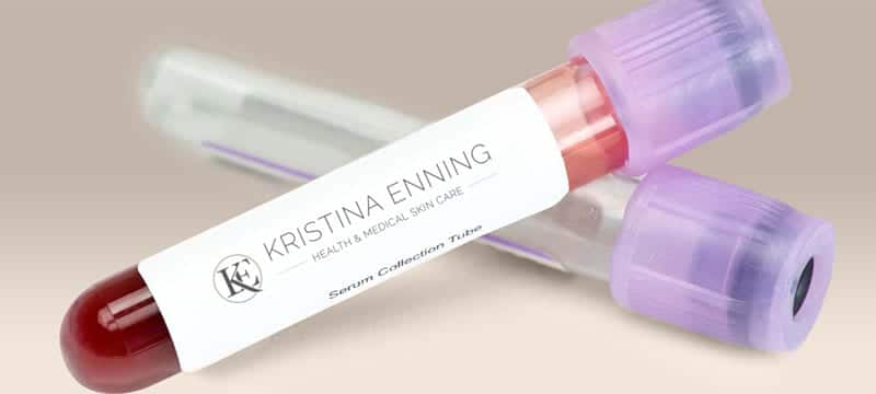 KRISTINA ENNING | HES/PRP